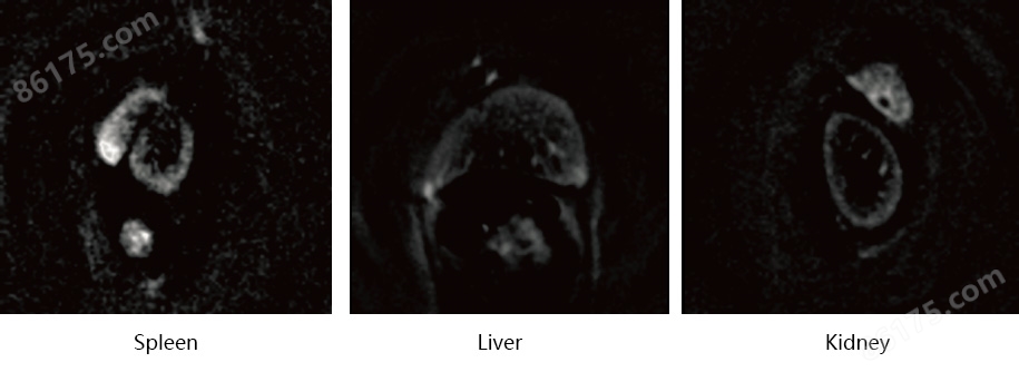 裸鼠部分器官直接扫描成像